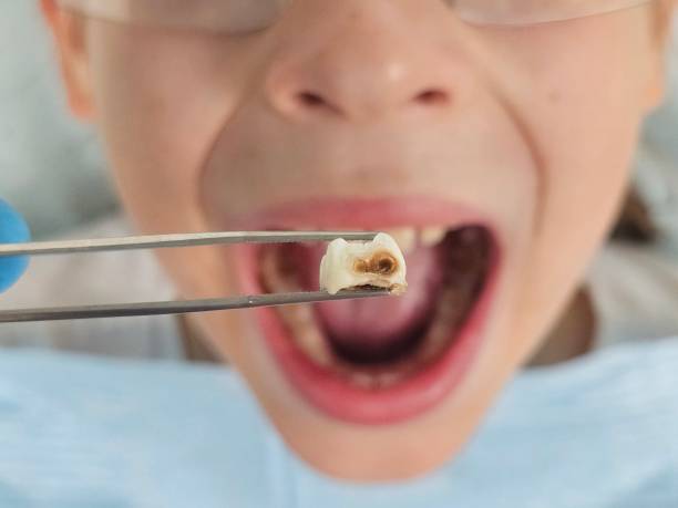 Best Broken Tooth Emergency  in Gallitzin, PA